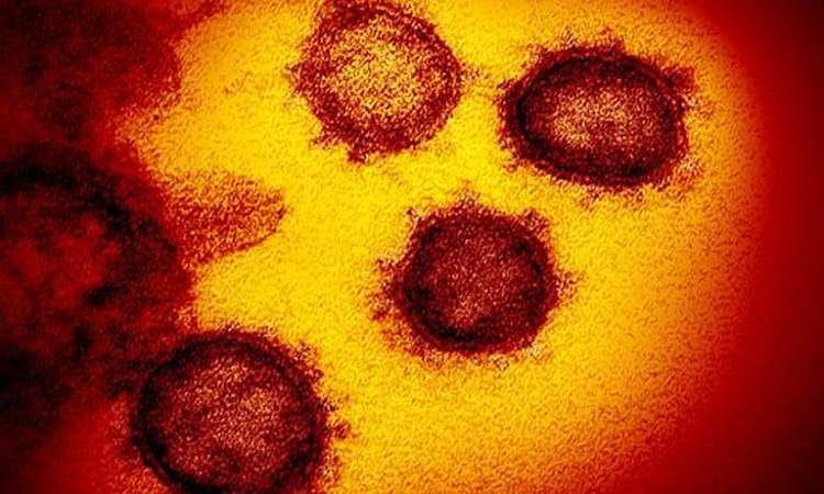 La variante delta del SARS-CoV-2 vuelve a poner en alerta a los sistemas sanitarios del mundo - National Institute of Allergy and Infectious Diseases - Infobae