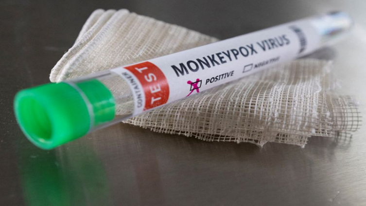 El país trasandino en alerta por el nuevo virus. Chile declaró alerta sanitaria por la viruela del mono. – NA