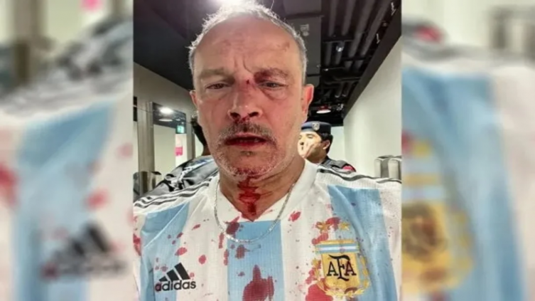 Hinchas mexicanos agredieron salvajemente a un argentino y su hijo en el estadio Lusail - Doble Amarilla